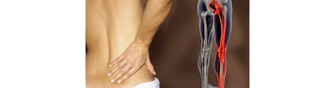 Homeopathic Medicine for Sciatica